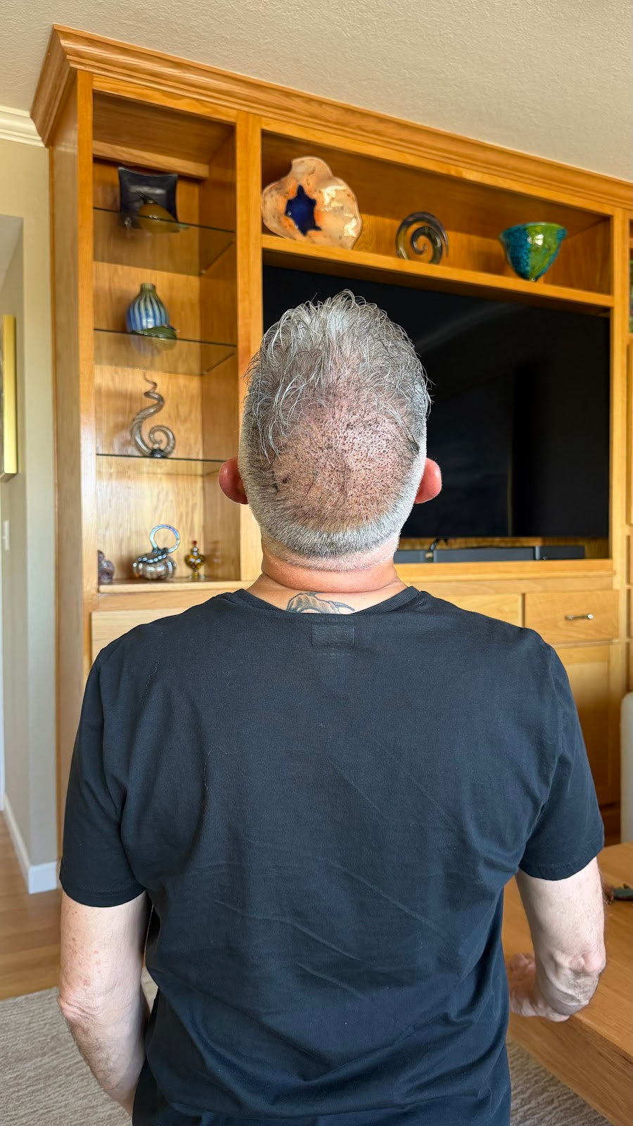 ReGrow Hair Restoration - Transplant & Restoration Clinic | Hair Transplant | Las Vegas, NV