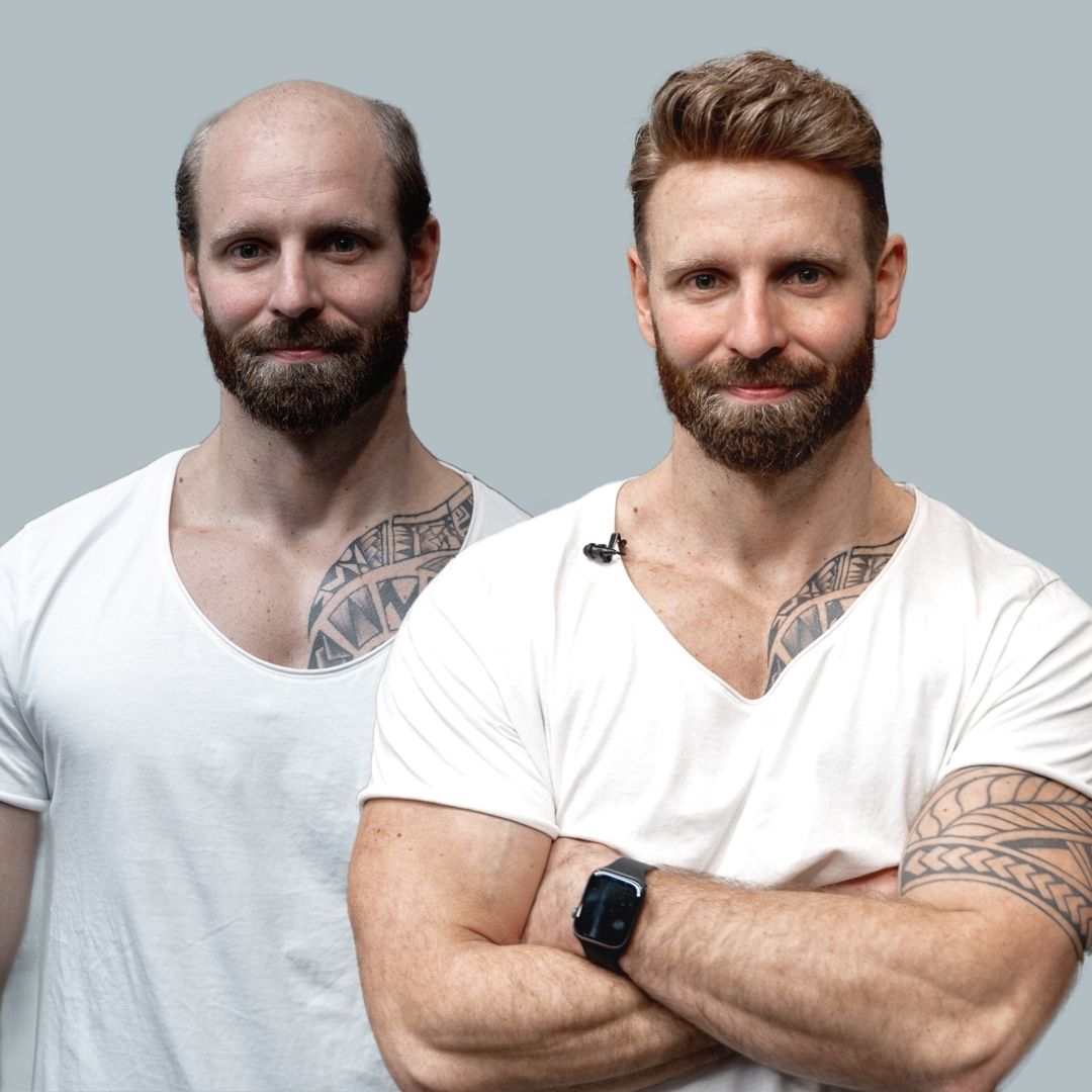 O.C. Hairsystems | Berlin - Hair Transplant clinic in Berlin, Germany