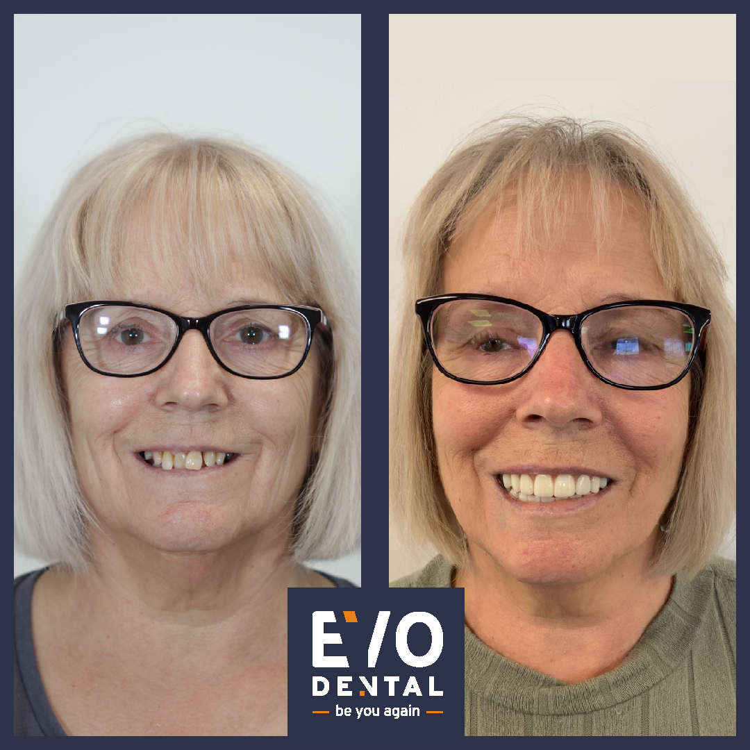 EvoDental — photo 5