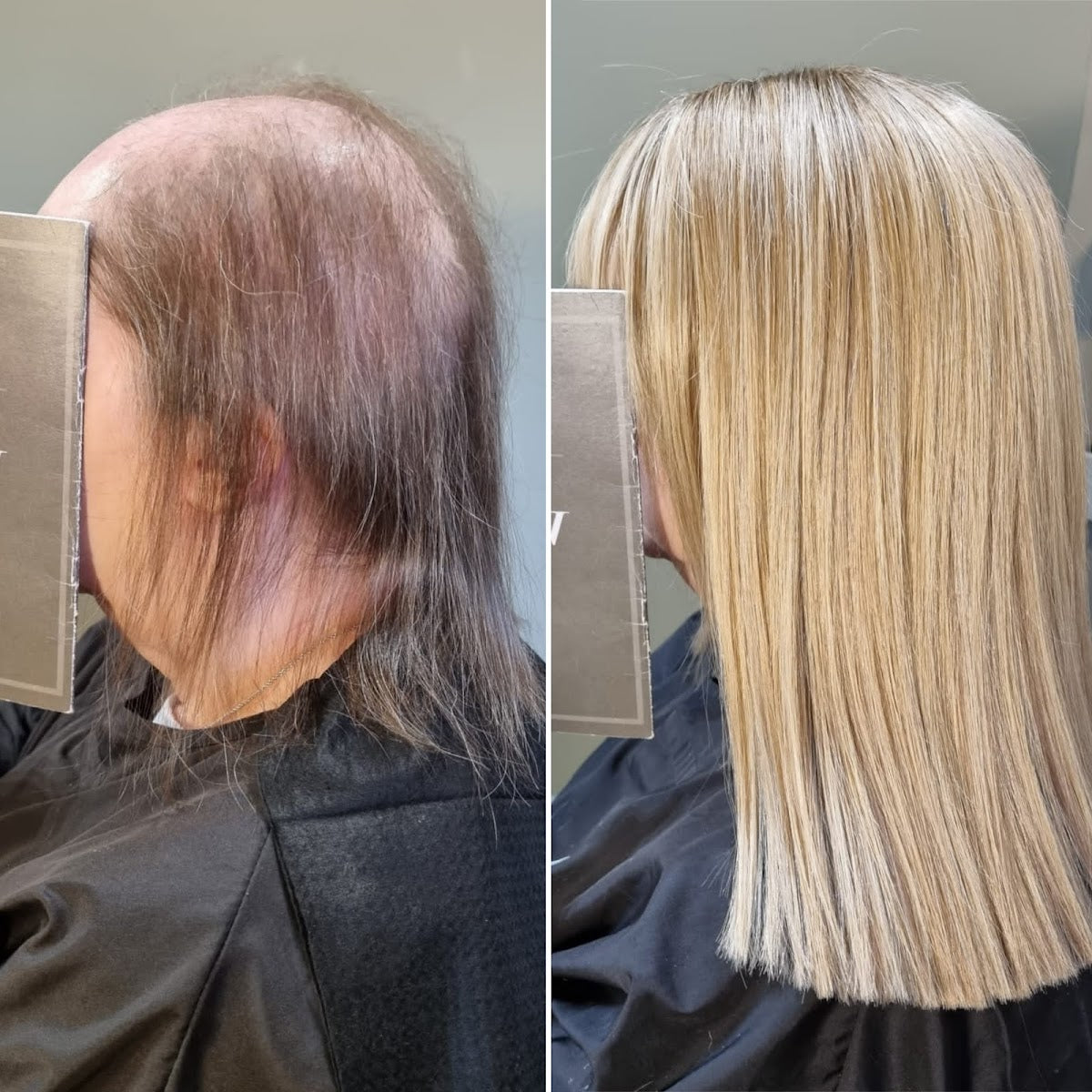 Verve Hair Loss Specialists UK I Salon & Trichology Clinic - Hair Transplant clinic in Sowerby Bridge, United Kingdom