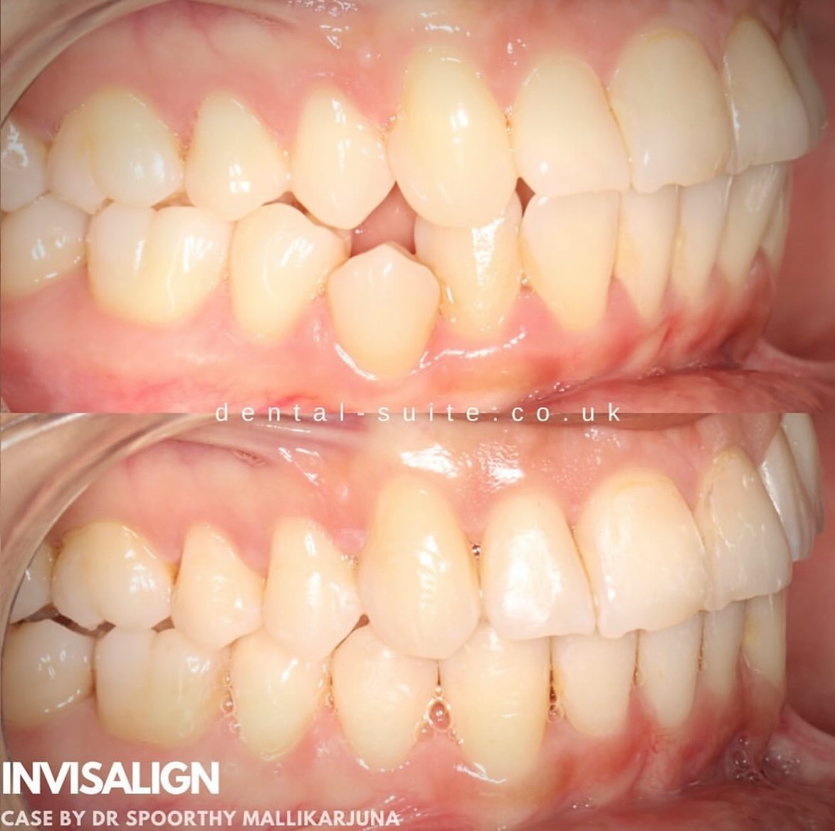 The Dental Suite - Leicester - Dental clinic in Leicester, United Kingdom