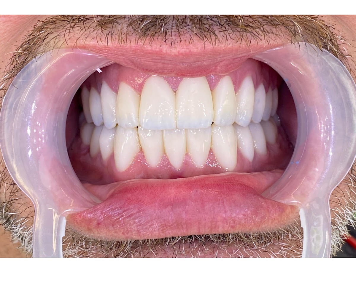 Dentisti in Albania-Biodent - Dental clinic in Tiranë, Albania