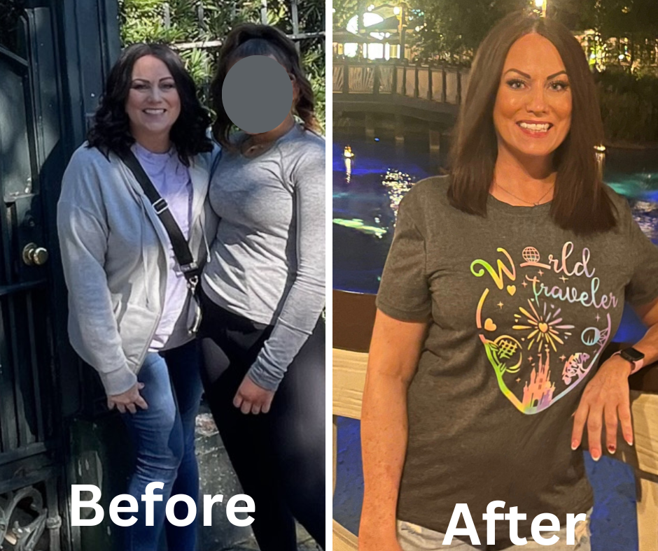 Weight Loss in Bixby - Axis HealthCare | Bariatric Surgery | Bixby, OK