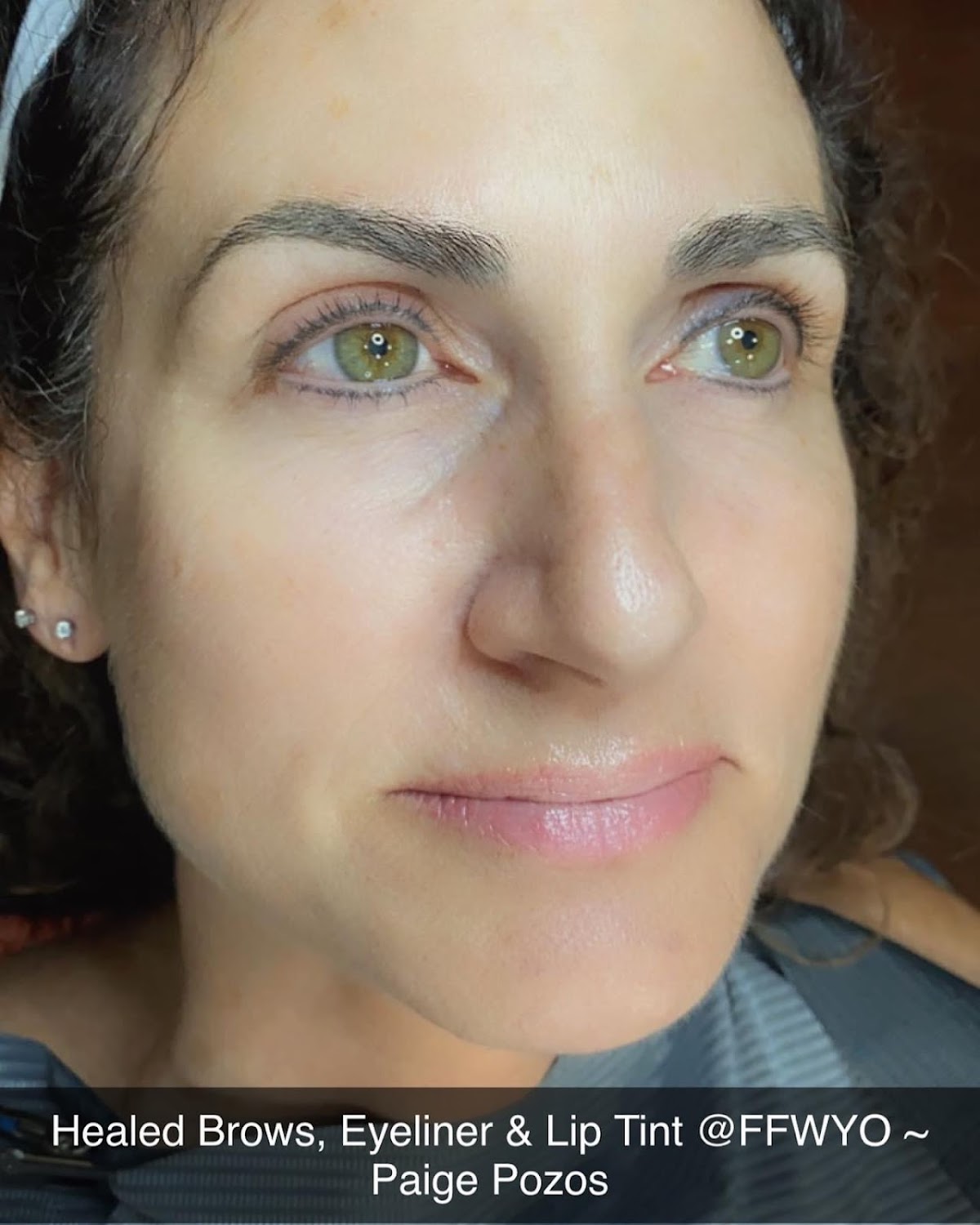 Forever Flawless Permanent Cosmetics, LLC | Hair Transplant | Sheridan, WY