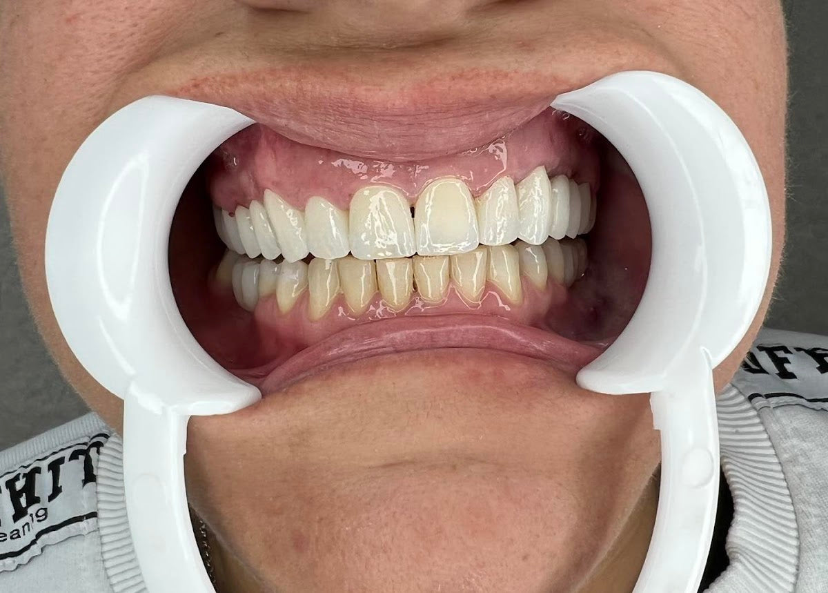 SOS Turismo Dentale Albania - Dental clinic in Tiranë, Albania