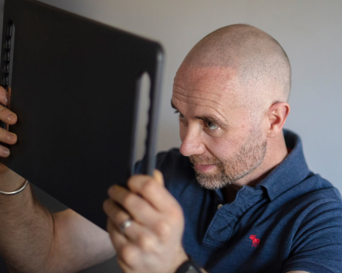 Restoration U - Hair Transplant clinic in Glasgow, United Kingdom