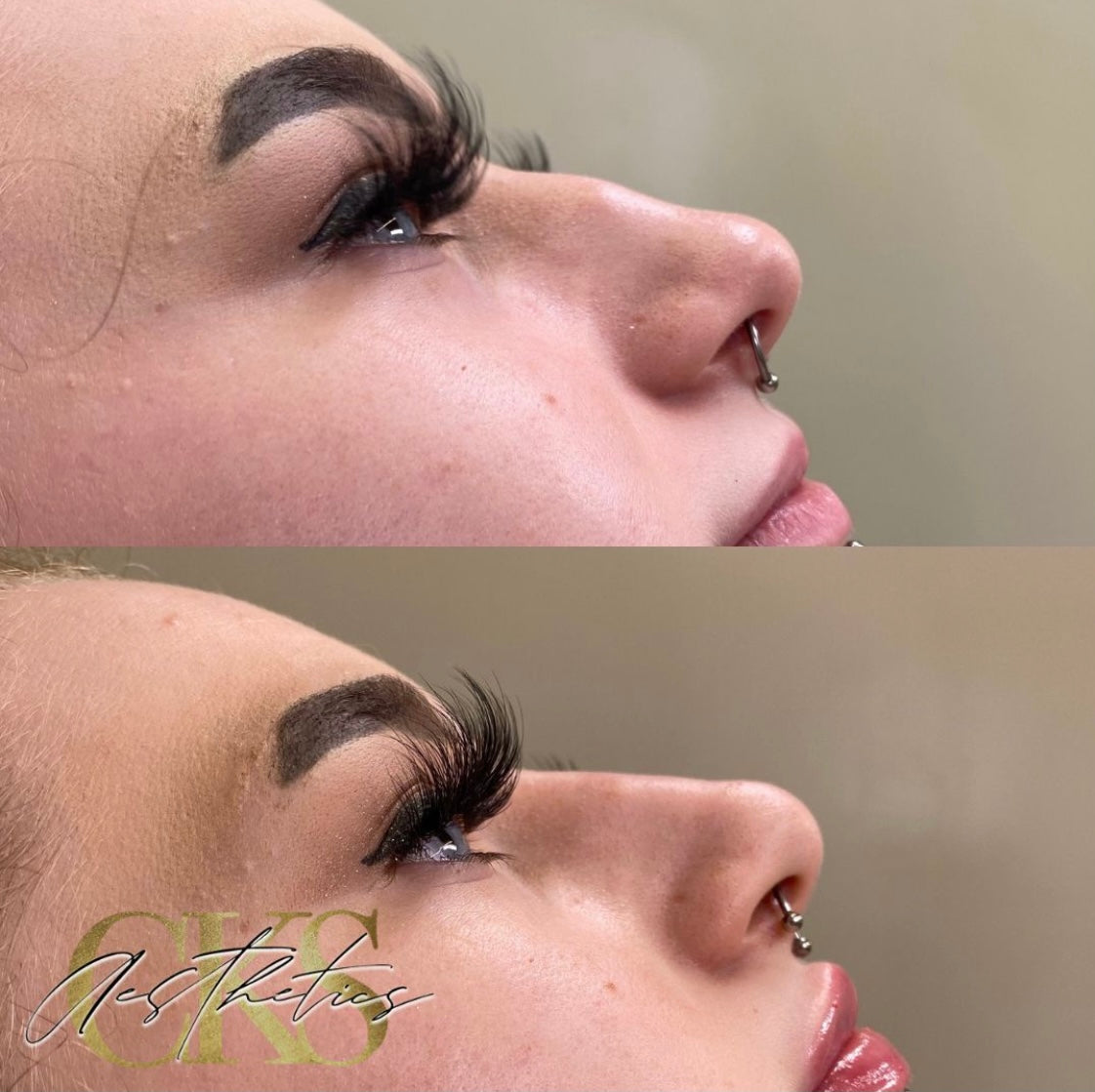 CKS Aesthetics and Laser - Aesthetic Surgery clinic in Nottingham, United Kingdom