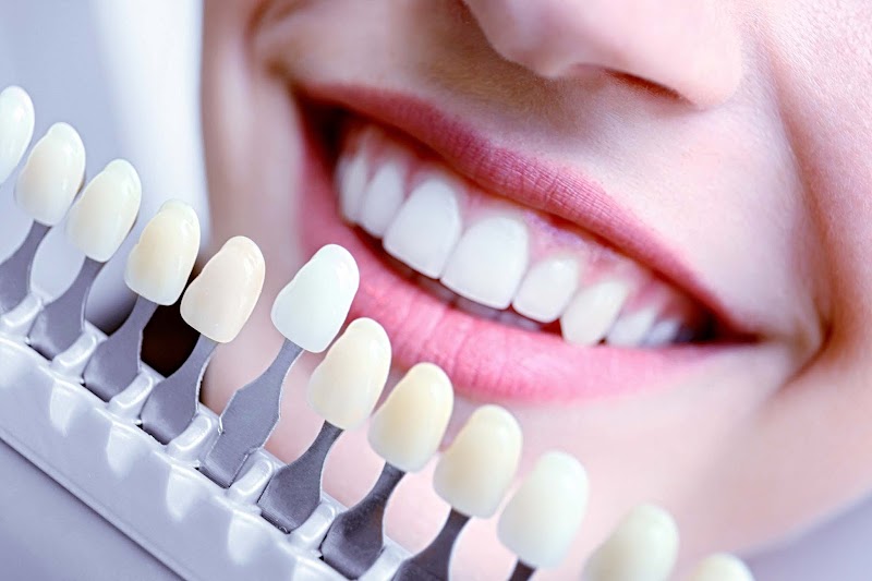 WHITE SMYLE - Dentalhygiene & Bleaching | Dental | 8048 Zürich