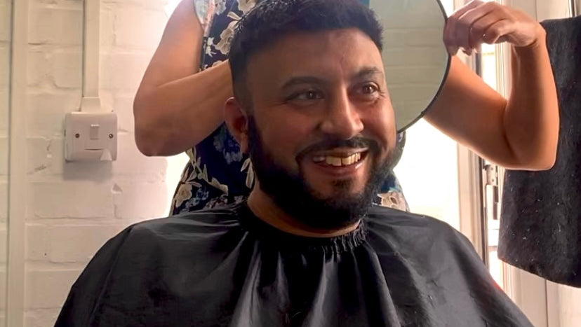 Peak Hair Restoration - Hair Transplant clinic in Sheffield, United Kingdom