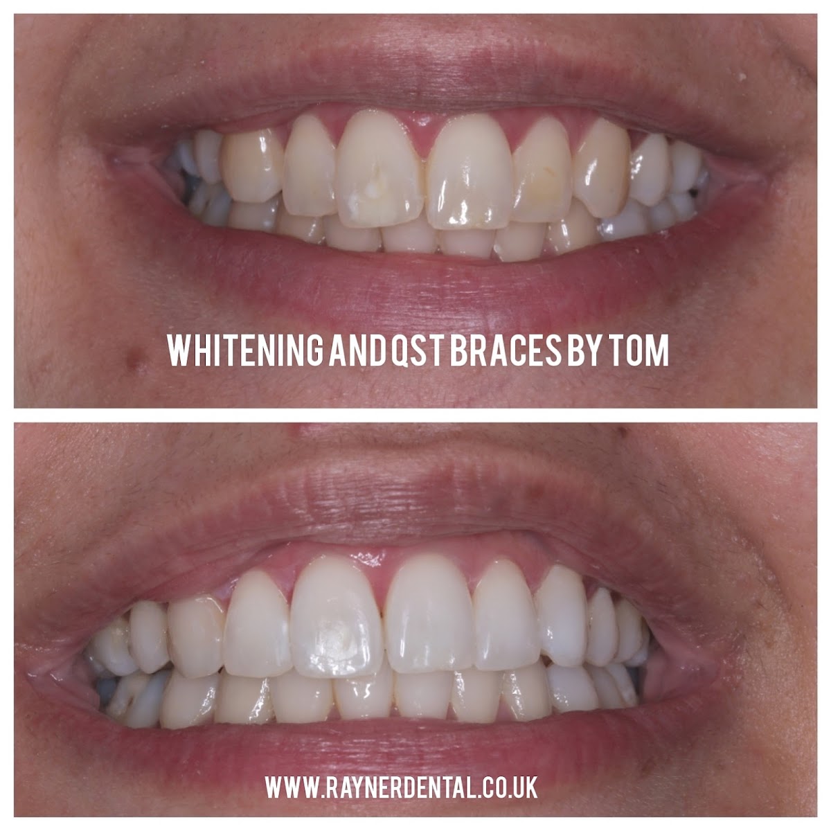 Rayner Dental Practice Wibsey - Dental clinic in Bradford, United Kingdom