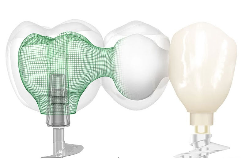 Anveli Dental Switzerland | Dental | 4058 Basel