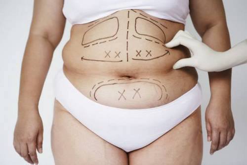 Medical Sculpturing & GYN Care | Aesthetic Surgery | Henderson, NV