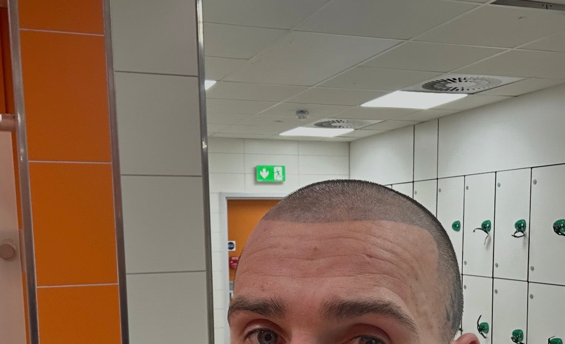 Scalp Ahead — Dr.Visor photo 2