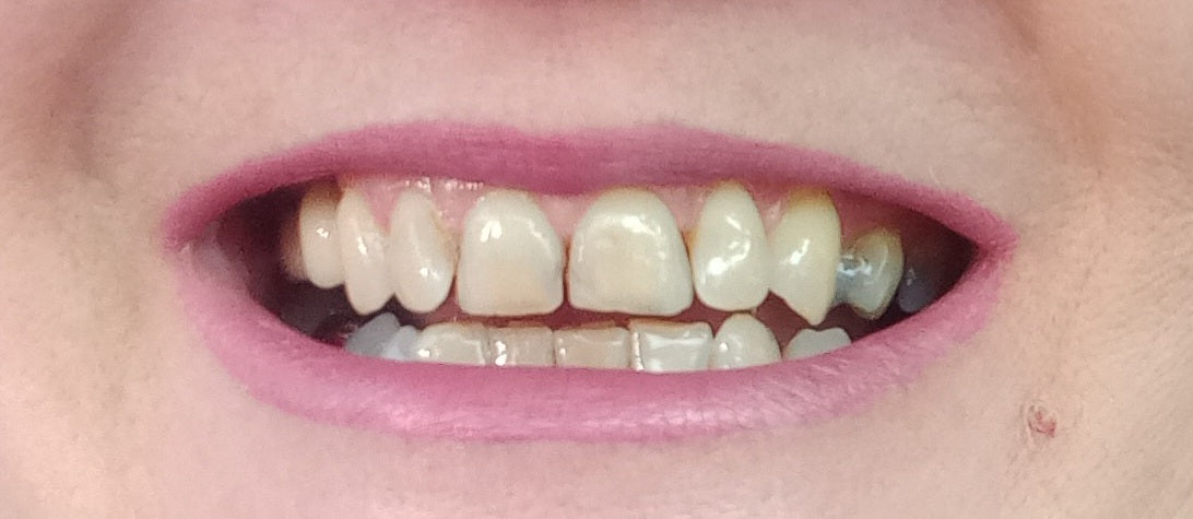 Carlton Dental Care - Dental clinic in Nottingham, United Kingdom