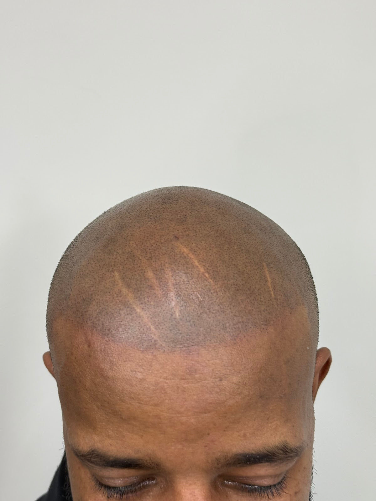 The Hairline Guy — photo 5