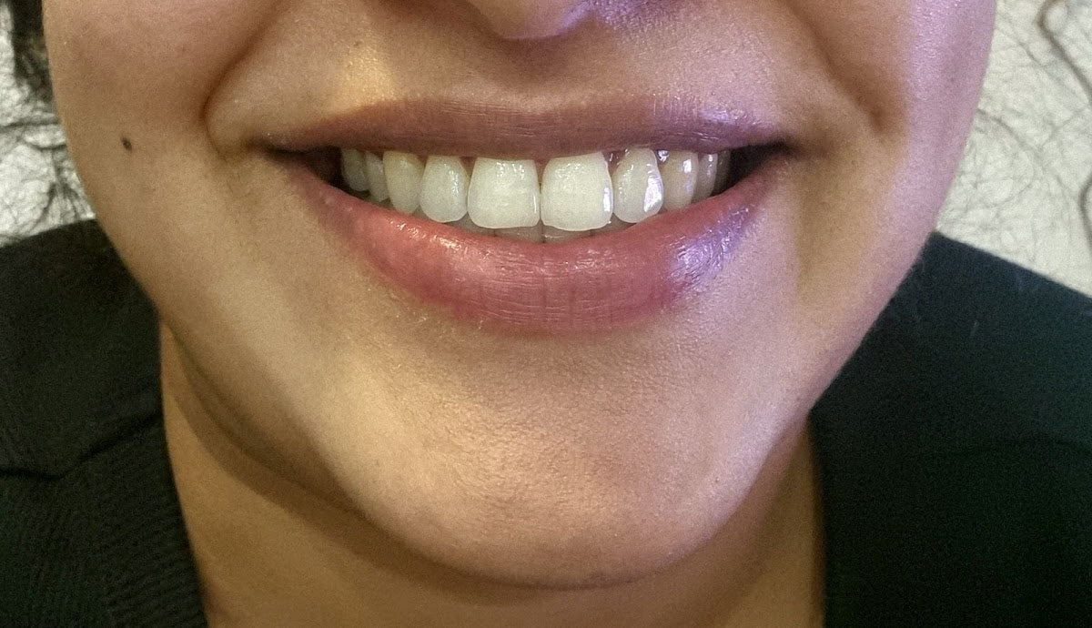 Square Mile Dental Centre — Dr.Visor photo 5
