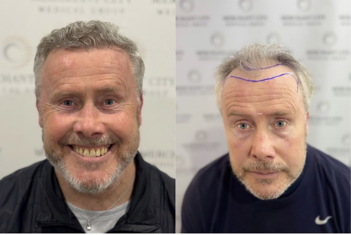 Merchant City Medical Group - Hair Transplant clinic in Glasgow, United Kingdom