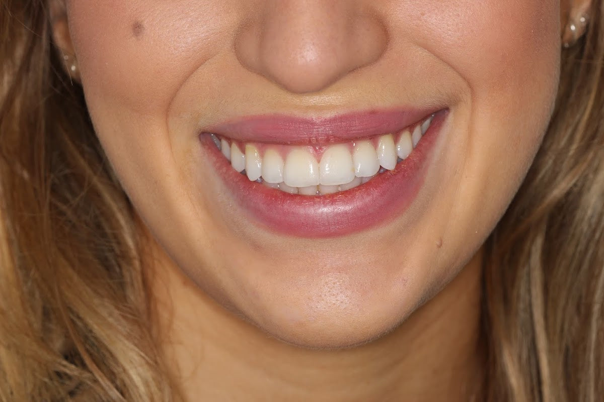 City Dental - Leeds — Dr.Visor photo 5