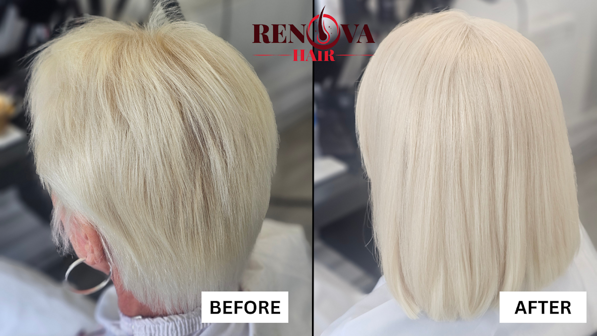 Renova Hair Trichology - Hair Transplant clinic in Leeds, United Kingdom