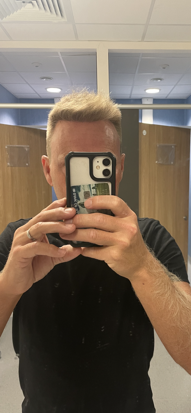 Akdeniz Antalya Saç Ekimi - Hair Transplant Antalya — Dr.Visor photo 4