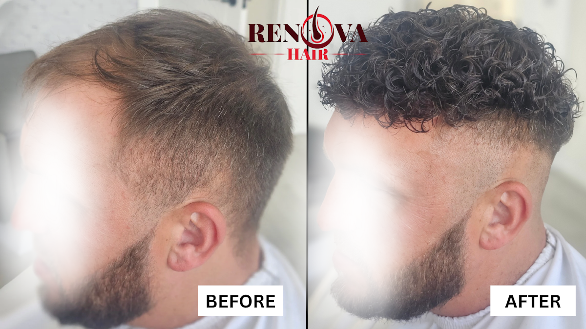 Renova Hair Trichology — photo 5