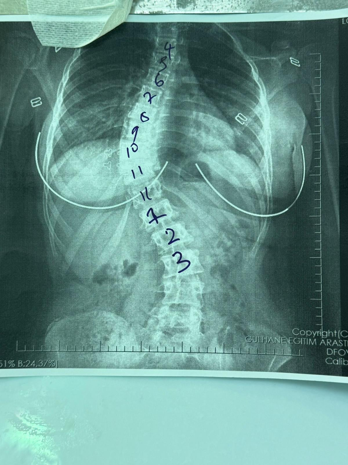 Prof. Dr. Tolga Ege, Omurga Cerrahisi — Dr.Visor photo 5