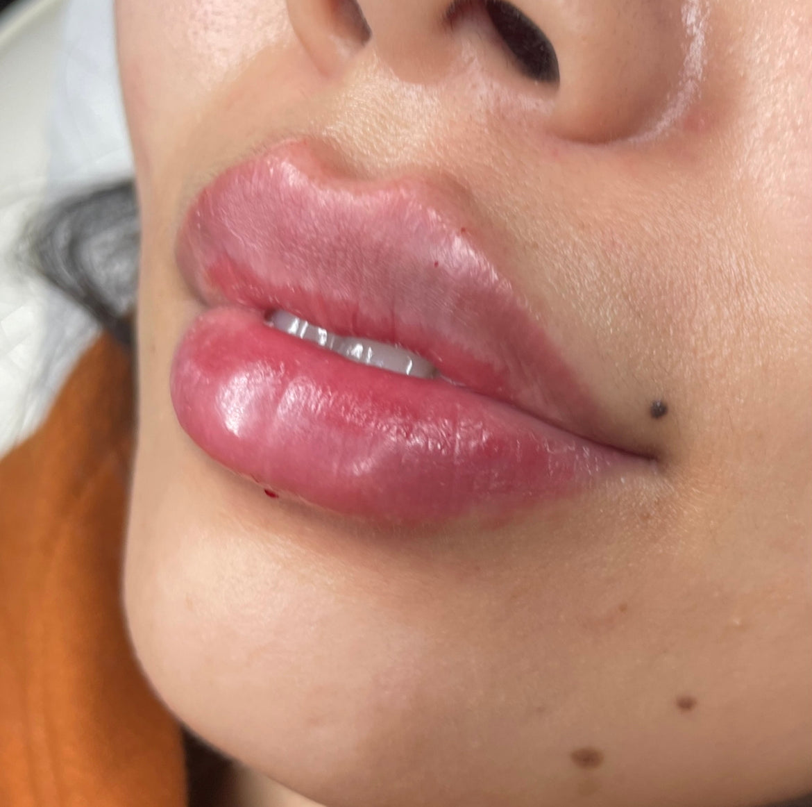 Sebastian-Rose Medical Aesthetics - Aesthetic Surgery clinic in Cardiff, United Kingdom