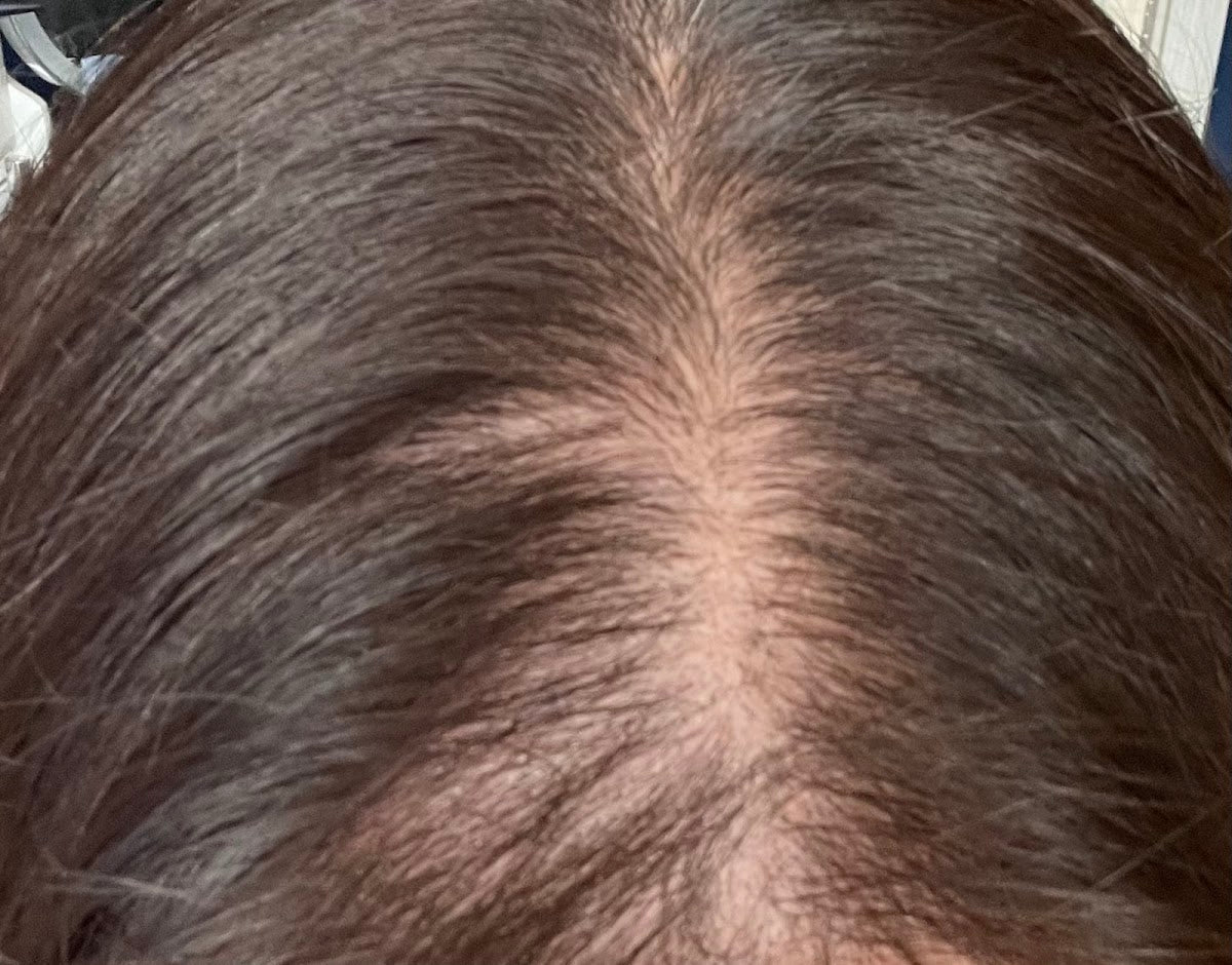 Cardiff Clinic Of Trichology - Hair Transplant clinic in Cardiff, United Kingdom
