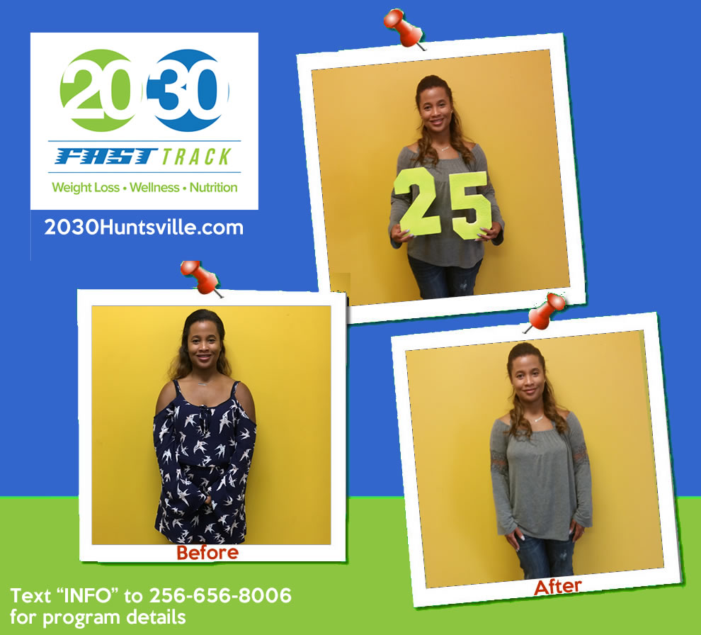 20/30 Fast Track | Bariatric Surgery | Huntsville, AL