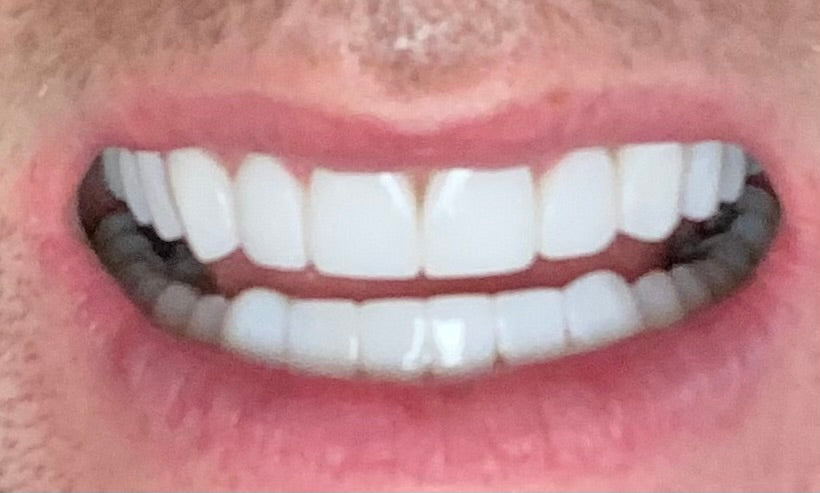Yorkshire Dental Suite Leeds — Dr.Visor photo 5