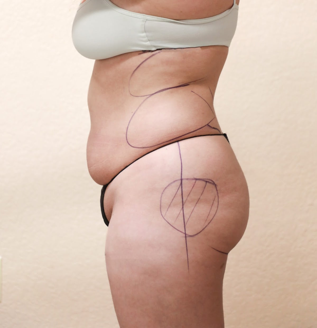 Milk and Honey Body Cosmetic Surgery | Aesthetic Surgery | Las Cruces, NM