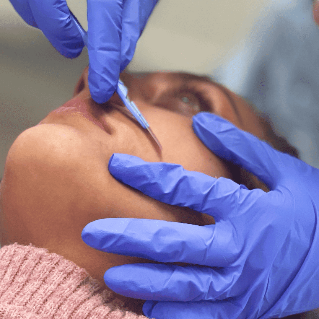 The Glam Fairies | Aesthetic Clinic | Microneedling Birmingham | PRP Birmingham | Chemical Peel Birmingham — photo 5