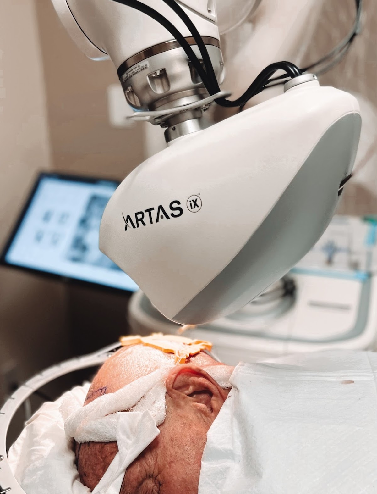 Hair Restoration Institute of the Hudson Valley | Hair Transplant | Poughkeepsie, VT