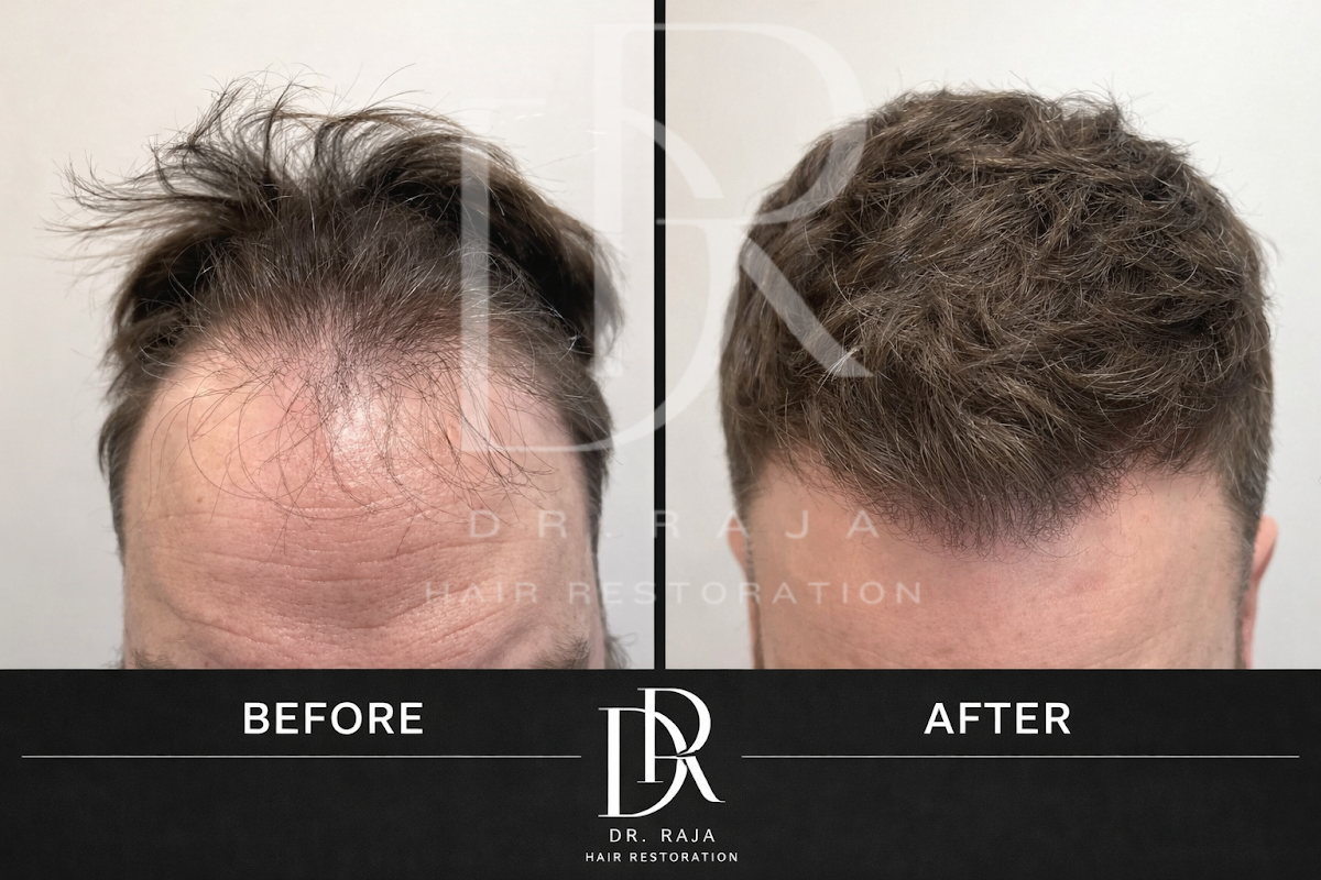 Dr. Raja Hair Restoration — photo 5