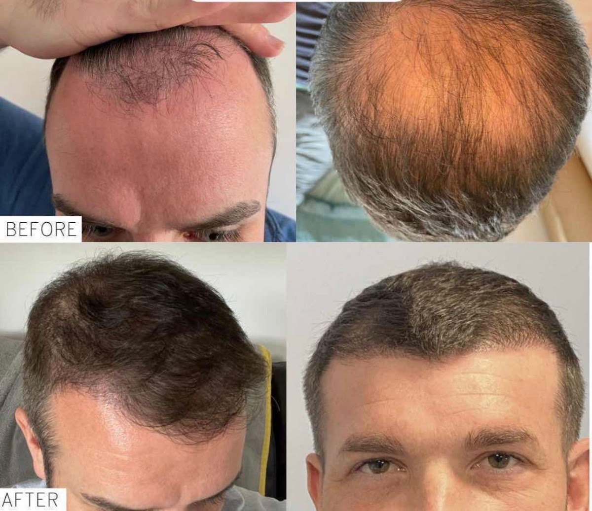 Harley street Hair transplants clinics Newcastle — photo 5