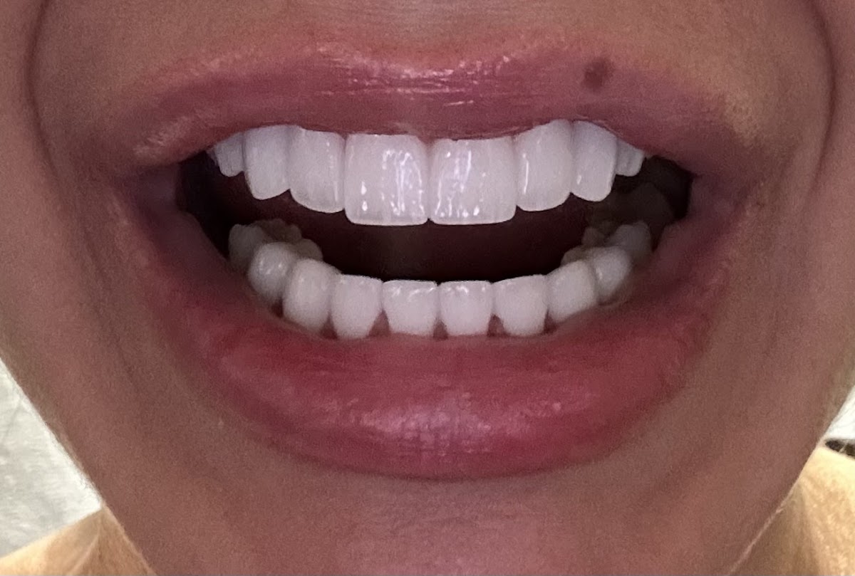 Dental World TR - Diş Kliniği — Dr.Visor photo 5