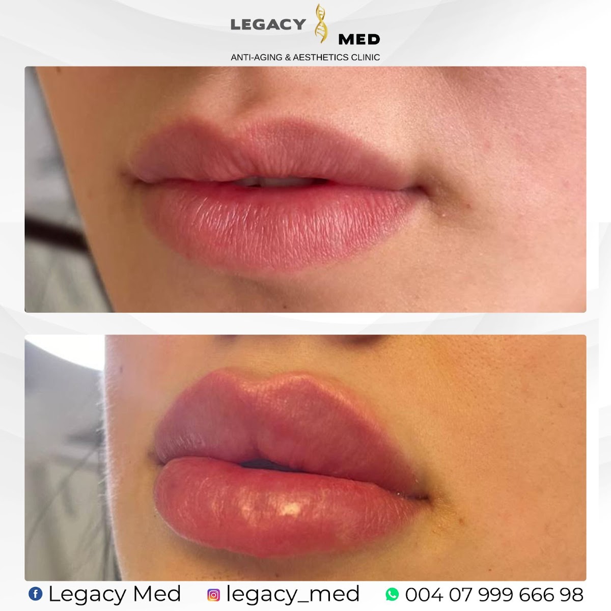 Legacy Med - Aesthetic Surgery clinic in București, Romania
