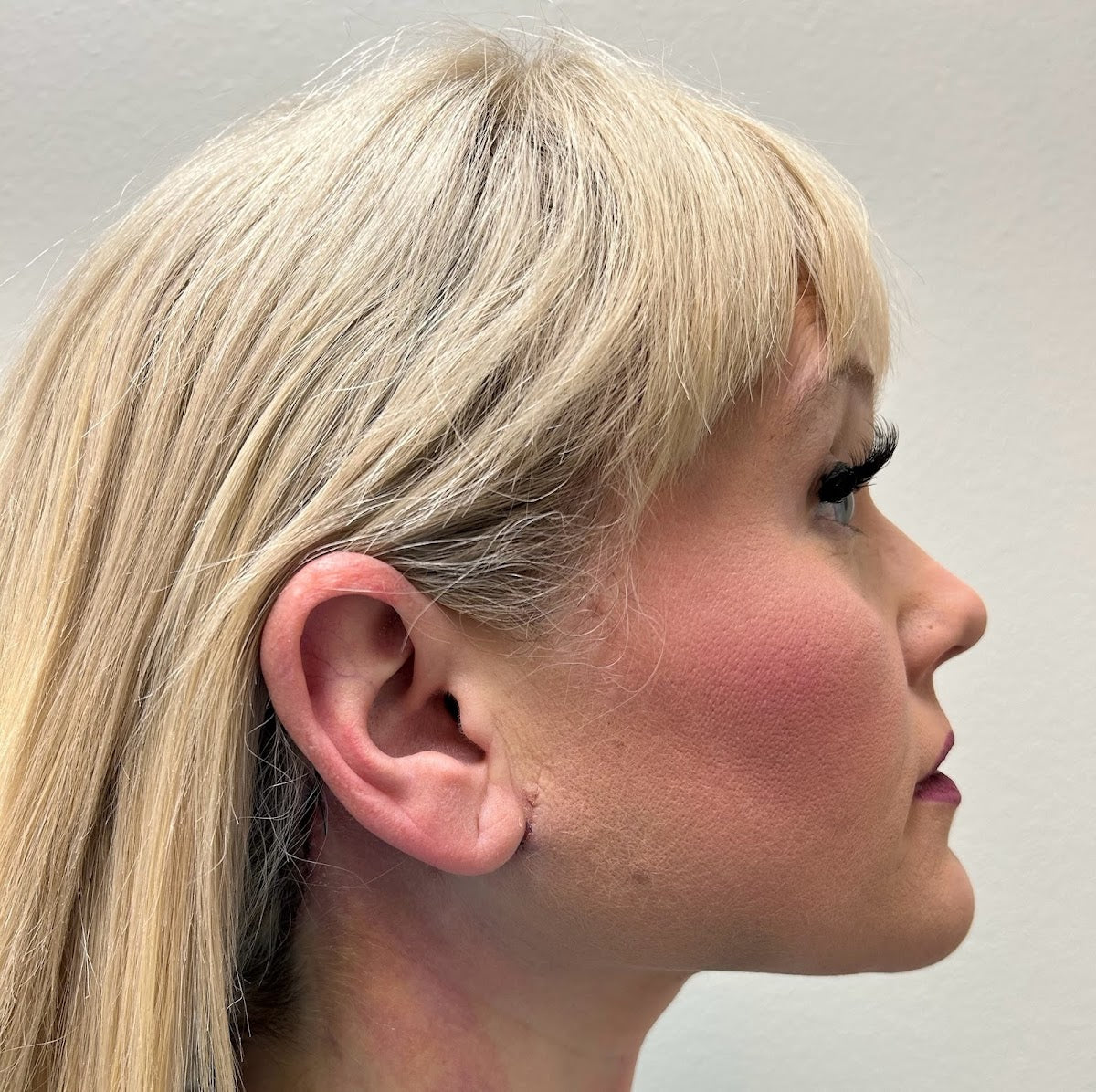 CARA Plastic Surgery & Laser Center | Aesthetic Surgery | Las Vegas, NV