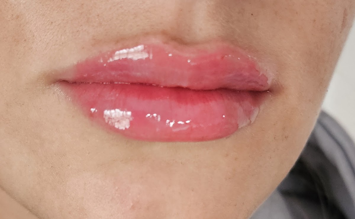 LL AESTHETICS - Aesthetic Surgery clinic in Belfast, United Kingdom