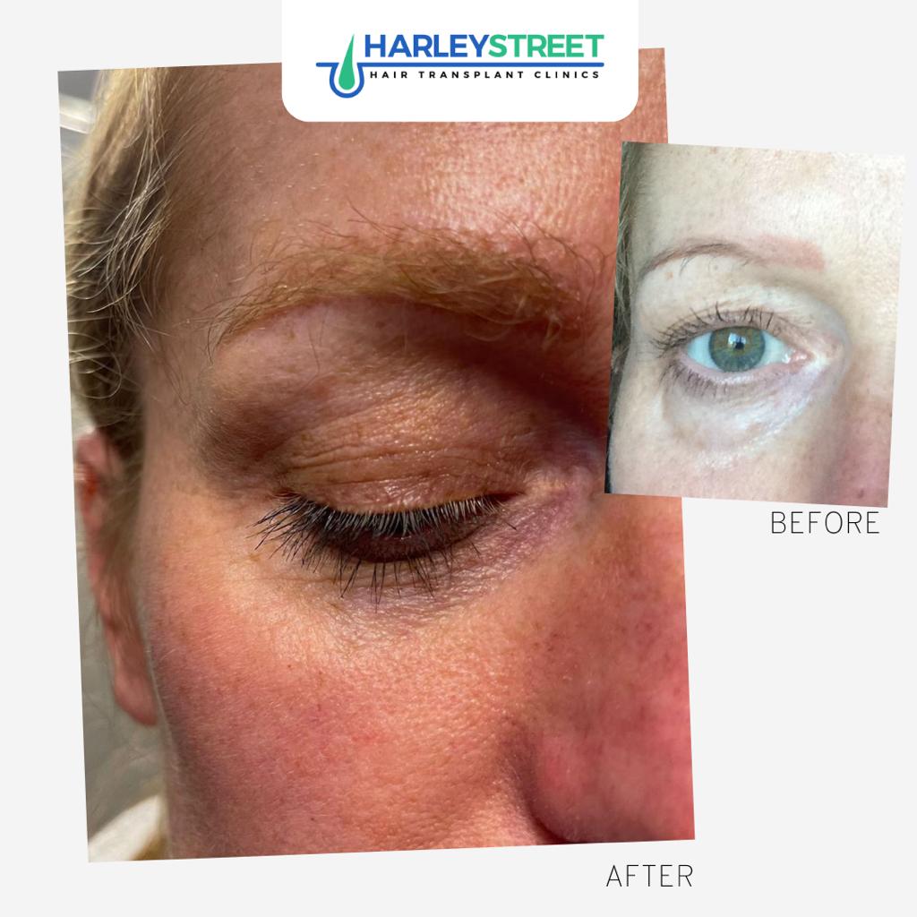 Harley Street Hair Transplant Clinics London — Dr.Visor photo 5