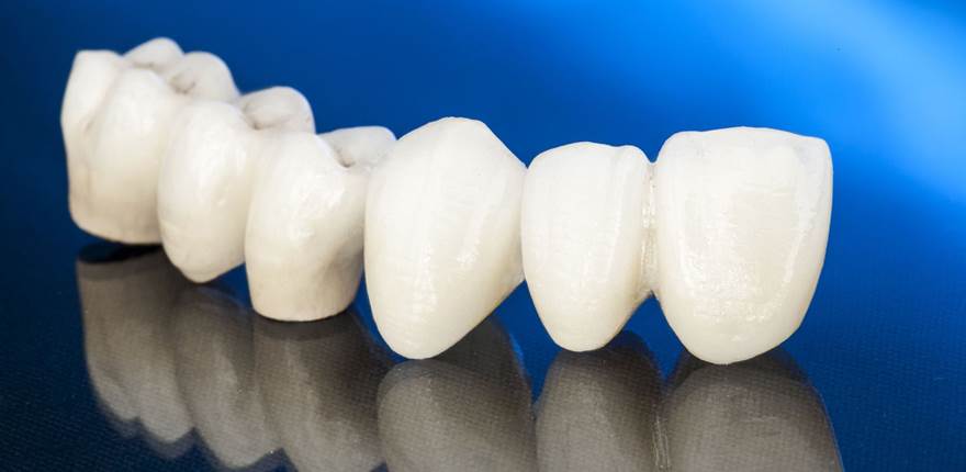Alanya Dental Clinic - Alanya Dental - Dental Tourism Turkey — Dr.Visor photo 5