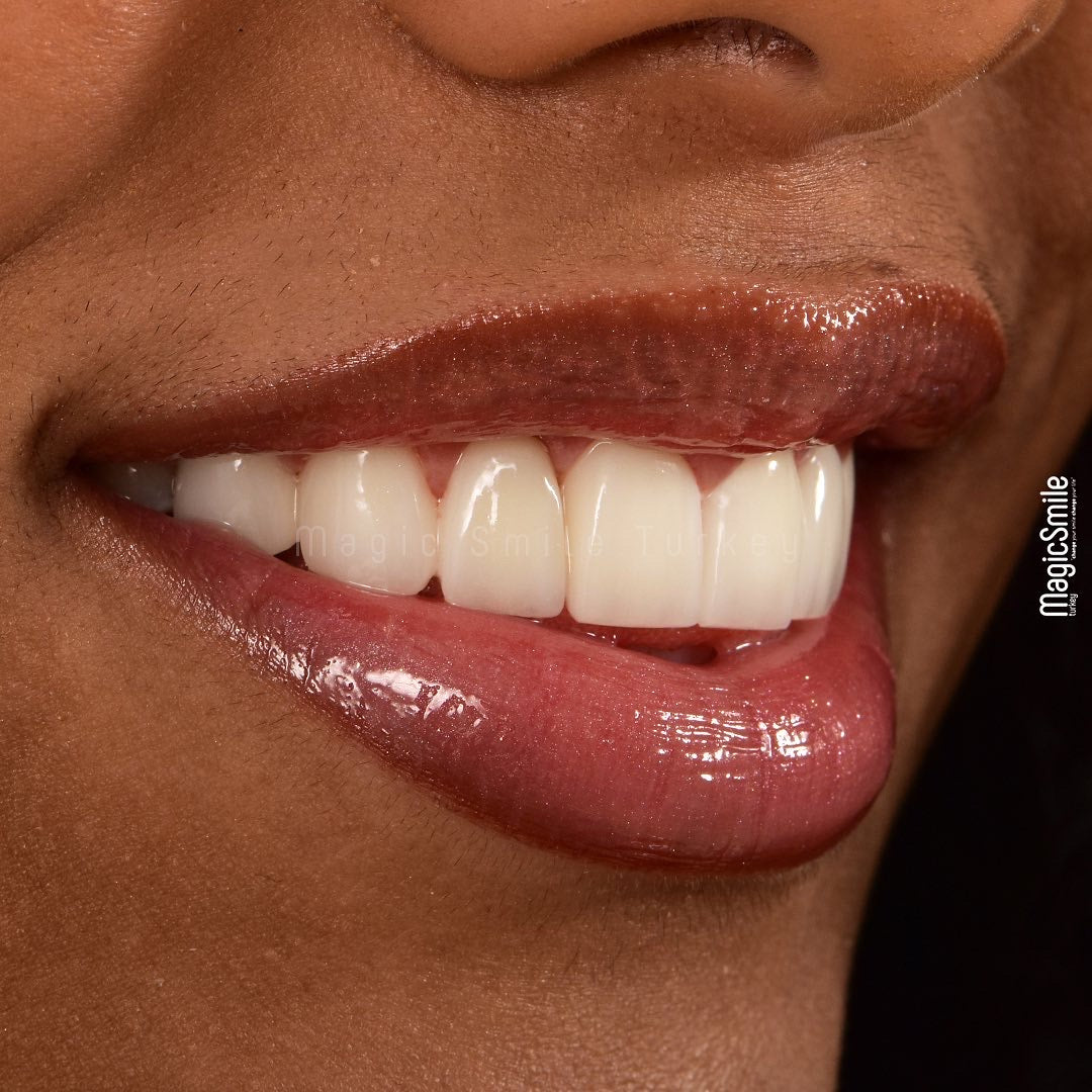 Magic Smile Turkey — Dr.Visor photo 5