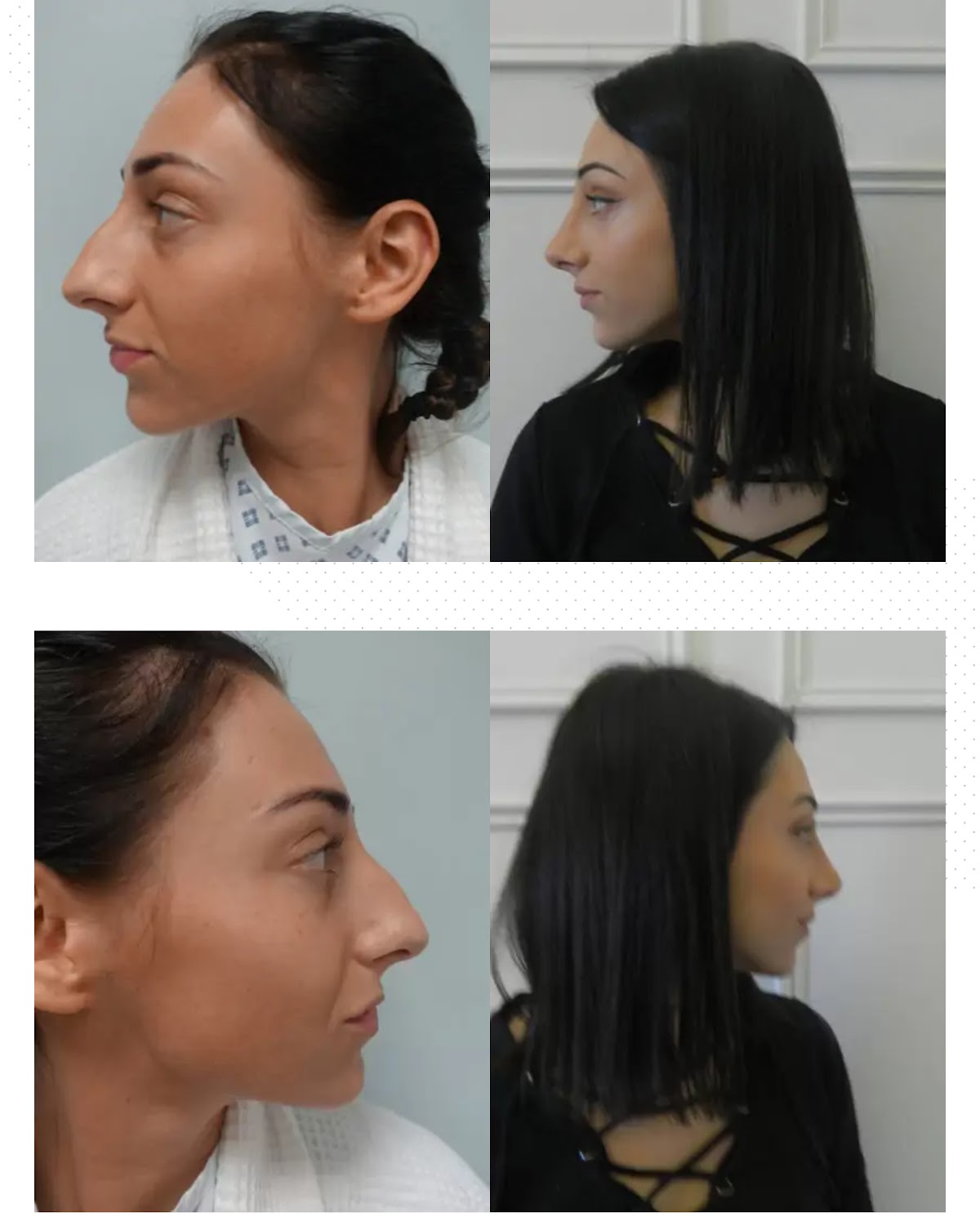 Harley Surgery: Dr. Riccardo Frati - Cosmetic Plastic Surgeon London — Dr.Visor photo 5