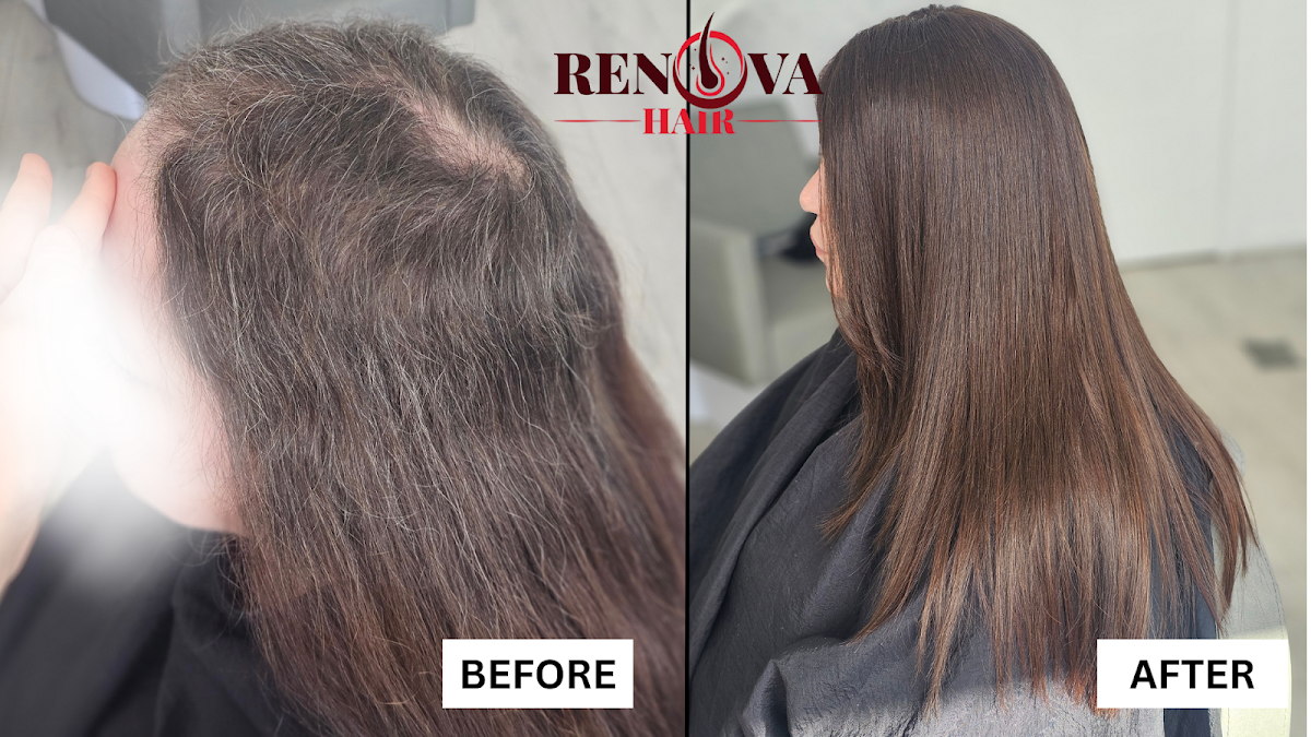 Renova Hair Trichology — Dr.Visor photo 5