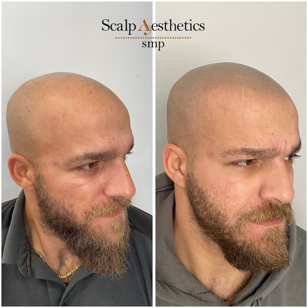 Scalp Aesthetics smp — Dr.Visor photo 5