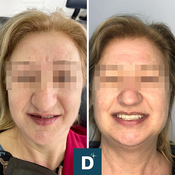 Denti a Vita Dental Clinic, Tirana, Albania