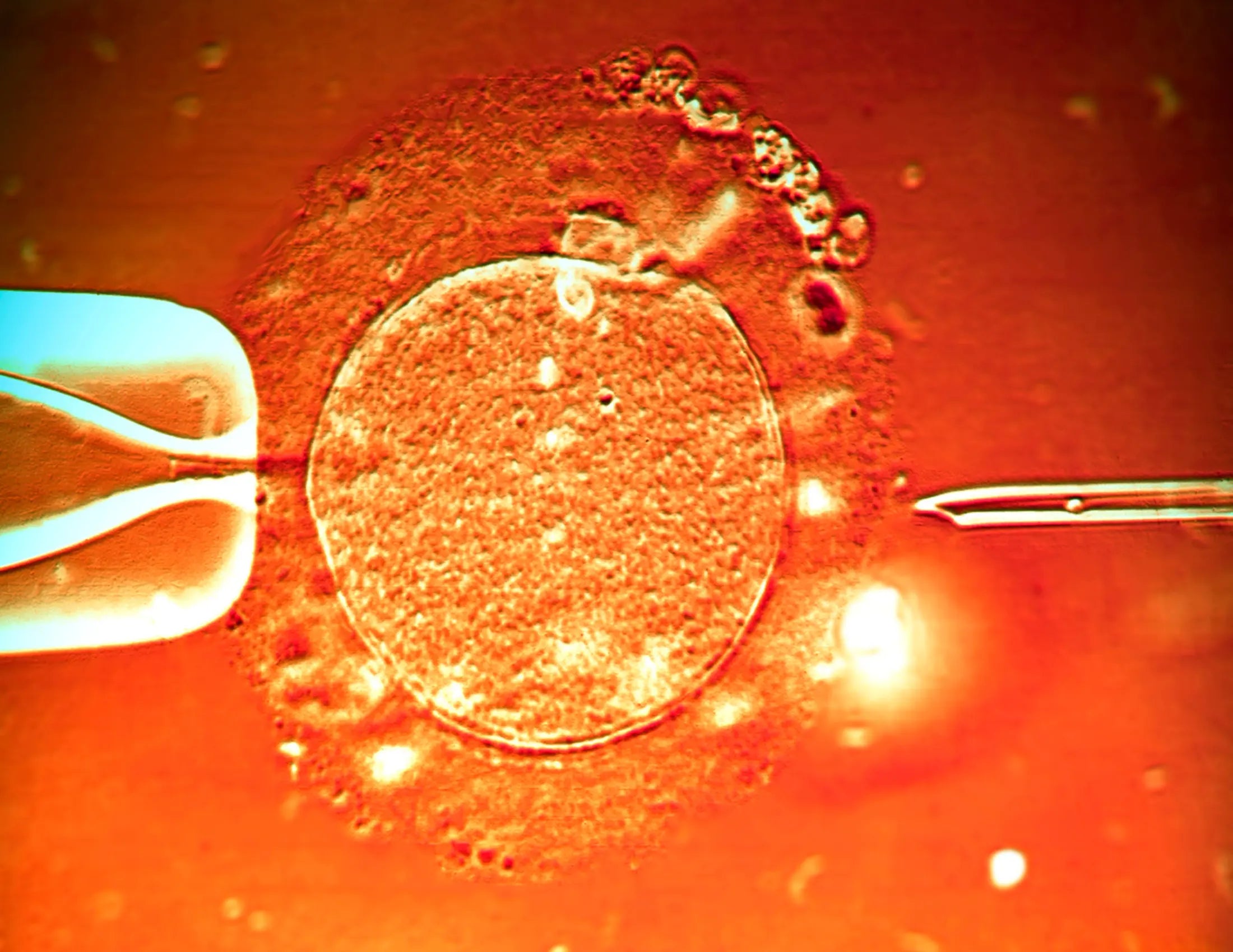 Navigating the Emotional Journey of IVF: Coping Strategies and Support ...