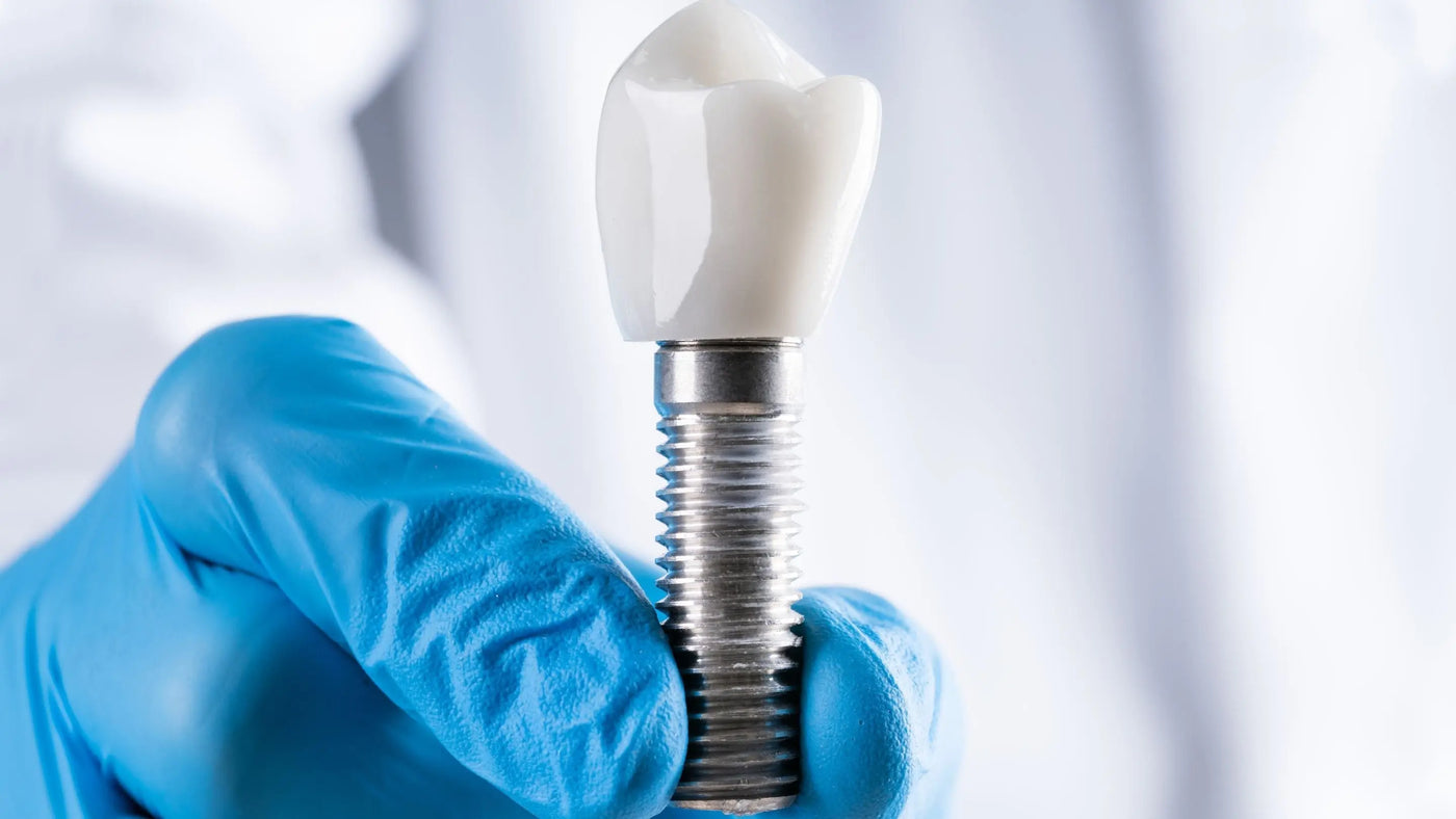 Choosing the Right Dental Implant Brand and Saving More with Dr.Visor