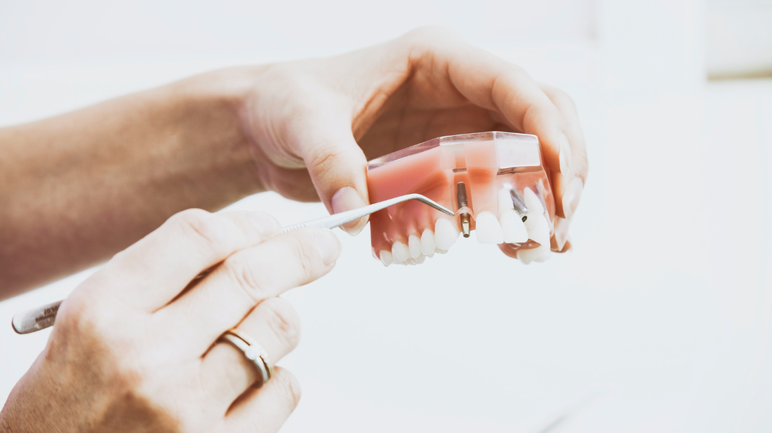 Premium Dental Implant Treatments in Türkiye