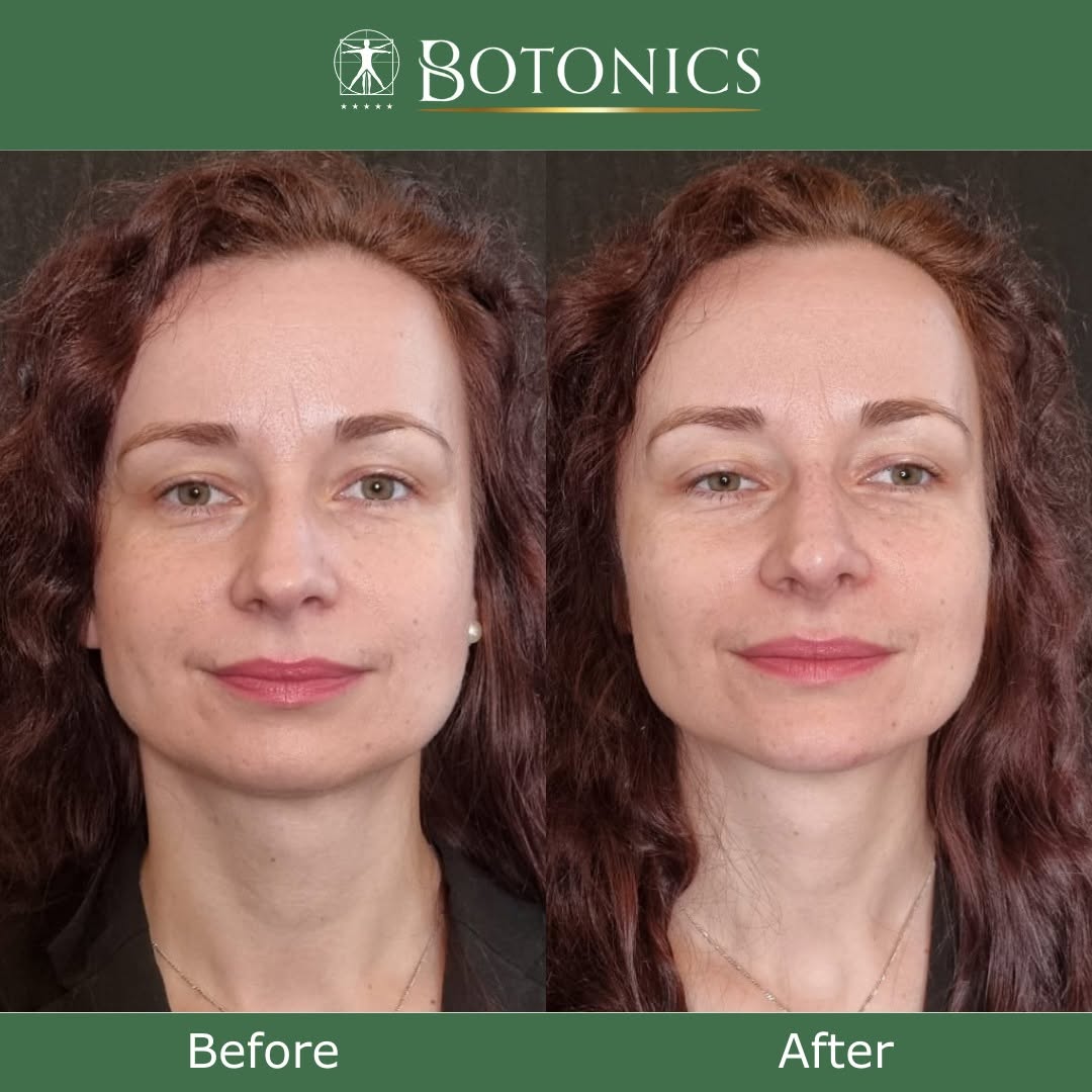 Botonics - Harley Street, Aesthetic Clinic